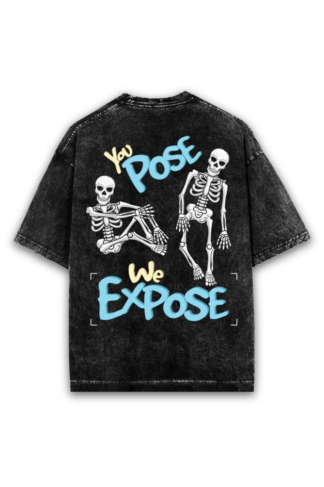 You Pose we Expose Xray Acid wash Oversized Tshirt Premium Streetwear by Russtees